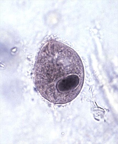 parazyty - Balantidium coli trophozoites.jpg