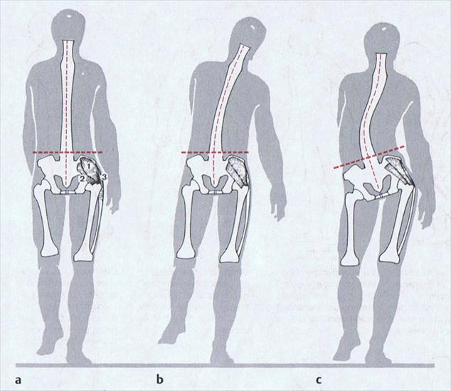 Diagnostyka - chód.jpg