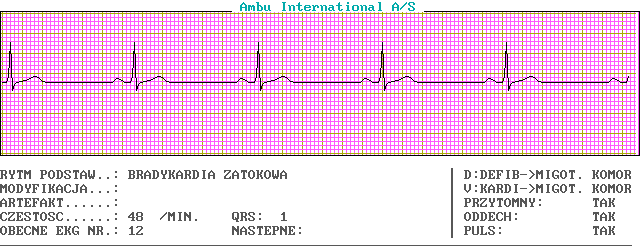 EKG wykresy z łyżek, Pierwsza Pomoc - c12-0.png