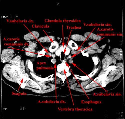 anatomia radiologiczna - 11.gif