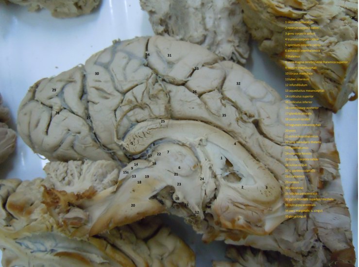 foty opisane mózg - mózg masla środek.jpg