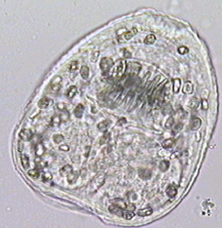 Zdjęcia - echinococcusgranulosus2.jpg