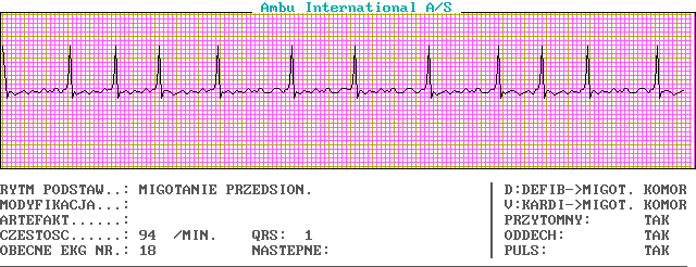 EKG wykresy z łyżek, Pierwsza Pomoc - c18-0.png